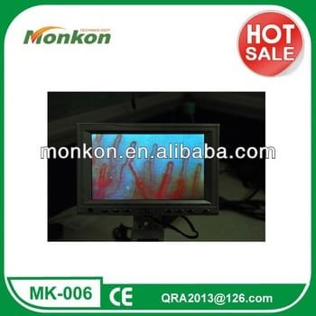 What is Capillary Microcirculation Microscope?