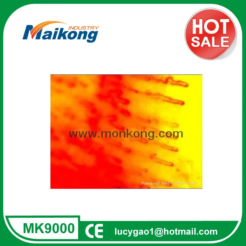What is MAIKONG video capillaroscopy nailfold capillaries?