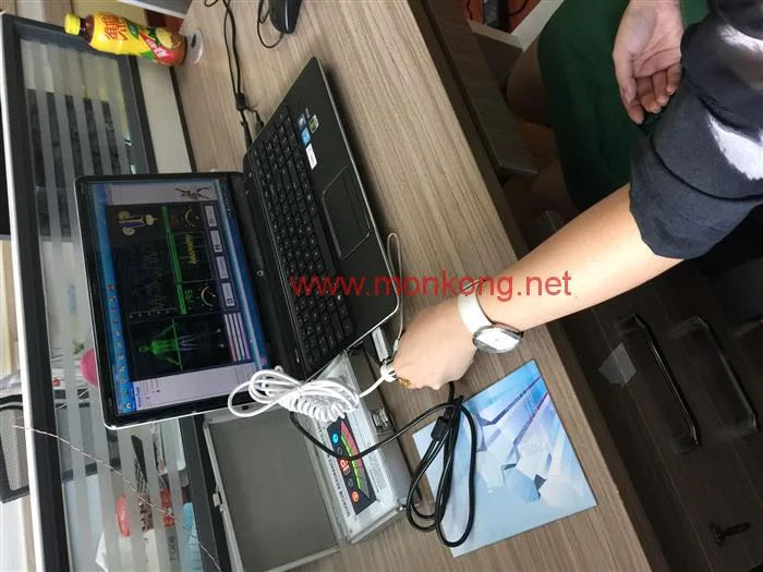 CE and OEM whole body biochemical analysis system type analyzer