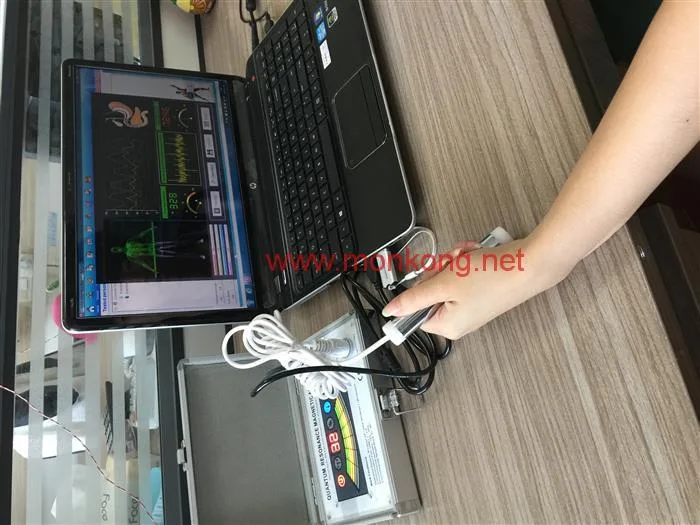quantum resonance magnetic body health analyzer