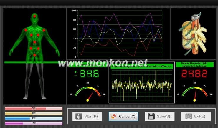 quantum resonance magnetic analyzer english 3.99 version software (10)