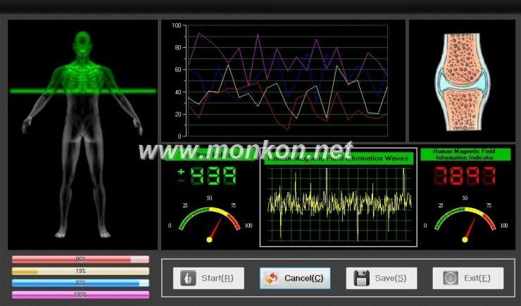 quantum resonance magnetic analyzer english 3.99 version software (11)