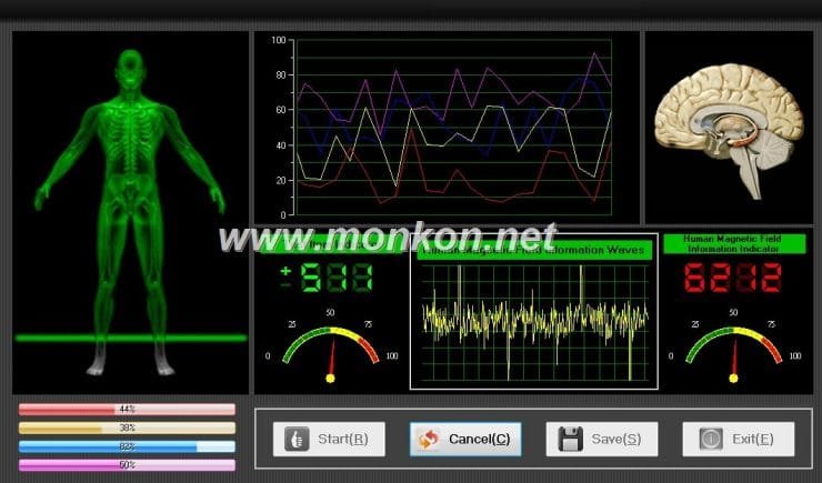 quantum resonance magnetic analyzer english 3.99 version software (12)