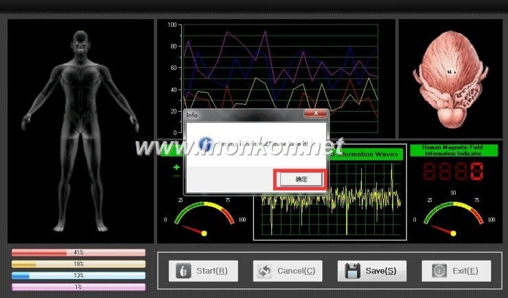 quantum resonance magnetic analyzer english 3.99 version software (13)