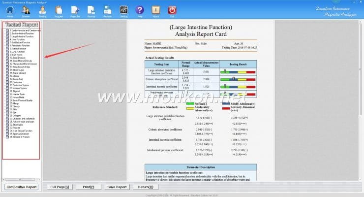 quantum resonance magnetic analyzer english 3.99 version software (18)