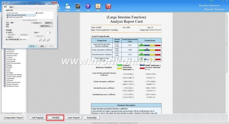 quantum resonance magnetic analyzer english 3.99 version software (21)