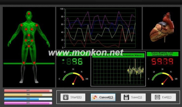 quantum resonance magnetic analyzer english 3.99 version software (8)