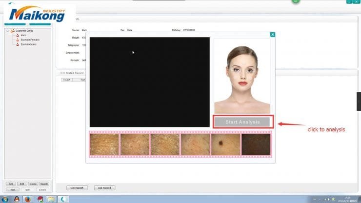 under-the-skin-analysis