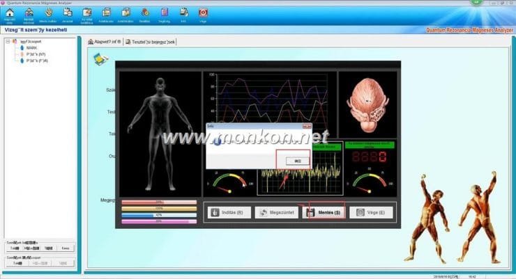how to use the Hungarian version Quantum Resonance Magnetic Analyzer Quantum Rezonancia Mágneses Analyzer (13)