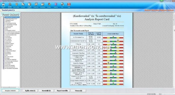 how to use the Hungarian version Quantum Resonance Magnetic Analyzer Quantum Rezonancia Mágneses Analyzer (16)