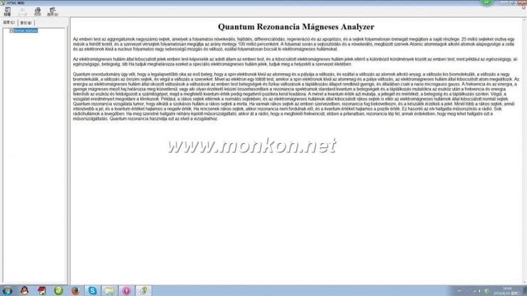 how to use the Hungarian version Quantum Resonance Magnetic Analyzer Quantum Rezonancia Mágneses Analyzer (21)