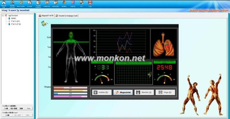 how to use the Hungarian version Quantum Resonance Magnetic Analyzer Quantum Rezonancia Mágneses Analyzer (22)