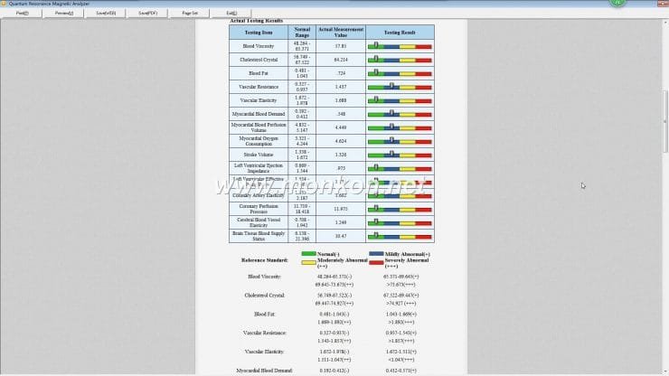 how to use the Quantum Resonance Magnetic Analyzer english 4.0.0 version software (16)