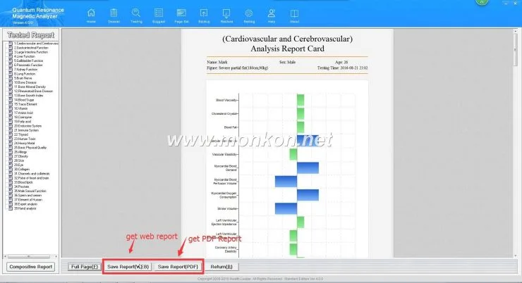 how to use the Quantum Resonance Magnetic Analyzer english 4.0.0 version software (17)