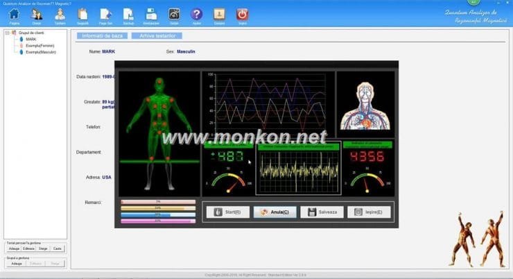 how to use the Romanian3.9.9 version Quantum Resonance Magnetic Analyzer (9)