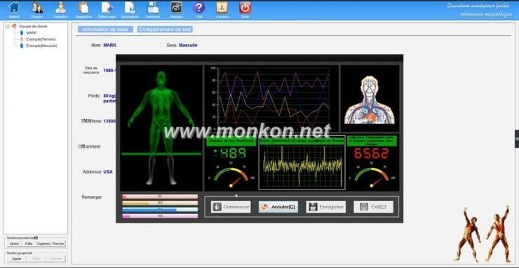 how to use the french version Quantum Resonance Magnetic Analyzer Quantum analyseur faible résonance magnétique (10)