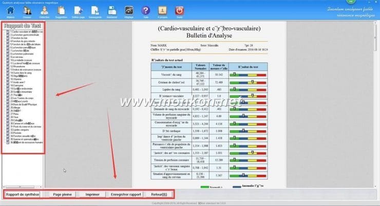 how to use the french version Quantum Resonance Magnetic Analyzer Quantum analyseur faible résonance magnétique (14)
