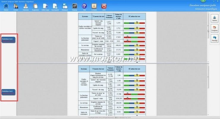 how to use the french version Quantum Resonance Magnetic Analyzer Quantum analyseur faible résonance magnétique (17)