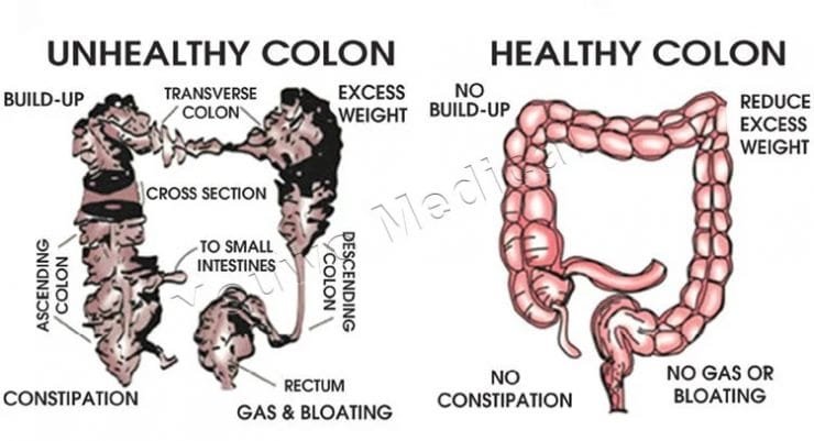 colon hydrotherapy machine for sale