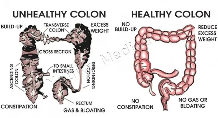colon hydrotherapy machine price