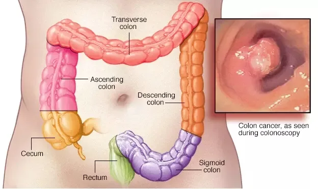 colon hydrotherapy machine price