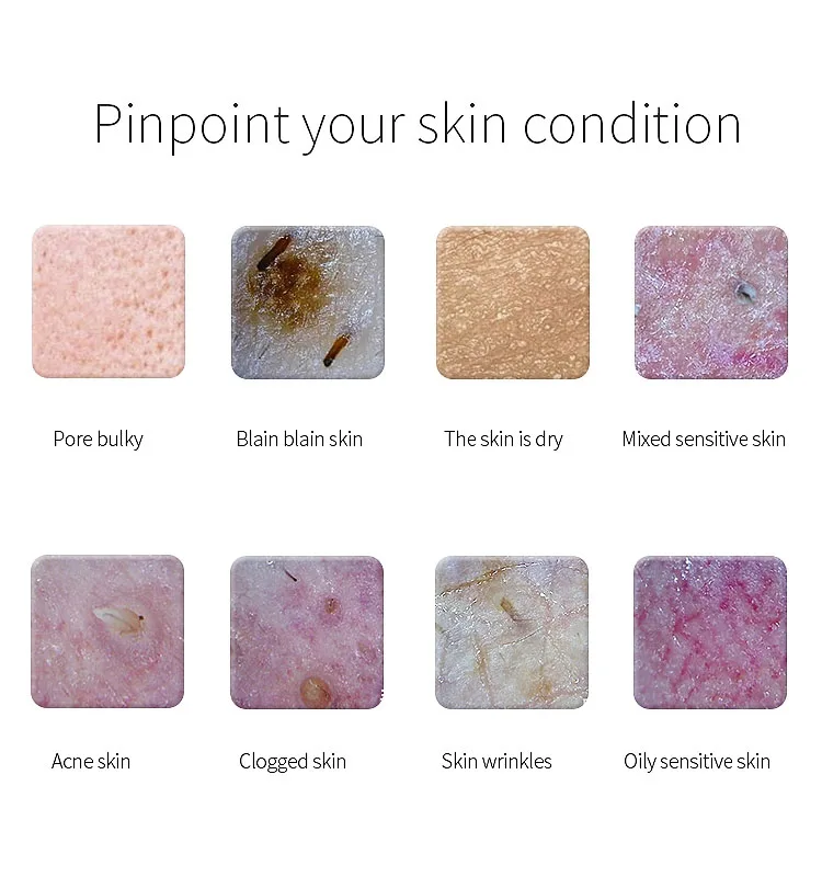 Maikong Skin Analyzer for MAC OS