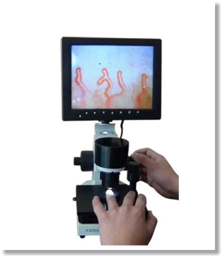 Microscope Microcirculation from MAIKONG?