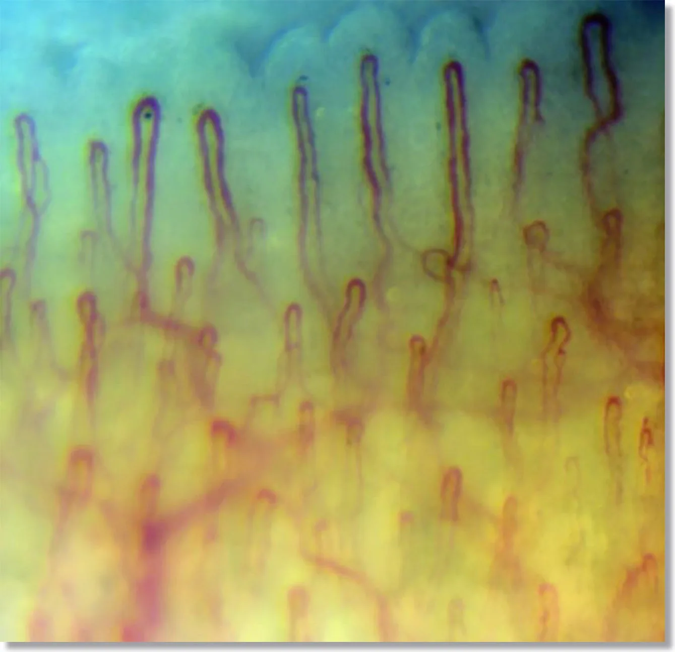 Microscope Microcirculation