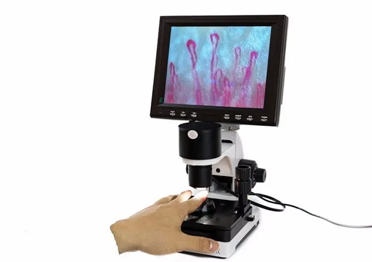 How About Nailfold Videocapillaroscopy vs Nailfold Capillaroscopy?