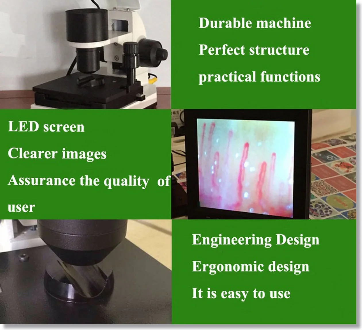 Nailfold Microcirculation Microscope