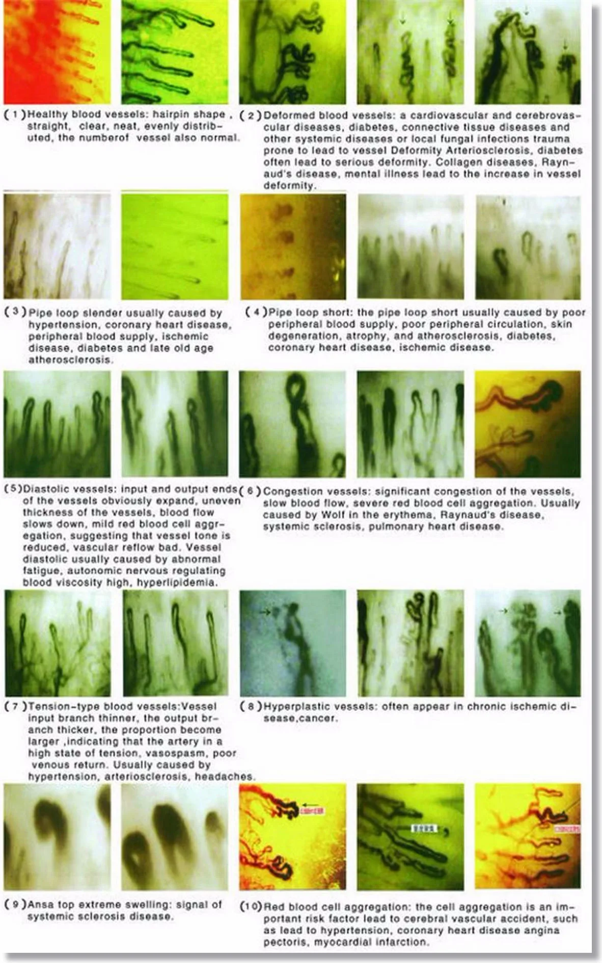 Nailfold Microcirculation Microscope